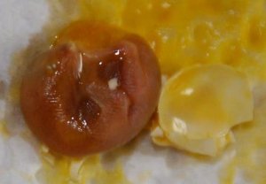 Embryo 2.jpg